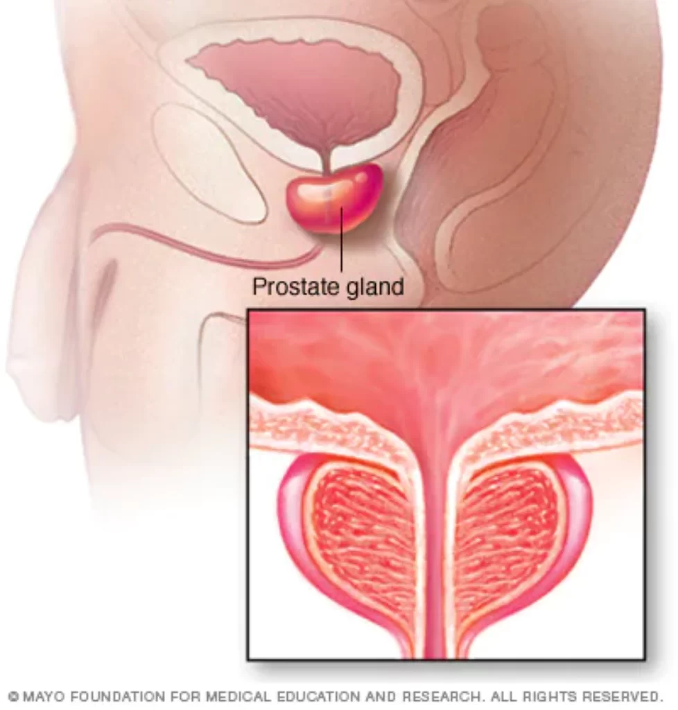 Where is the Prostate Gland Located?