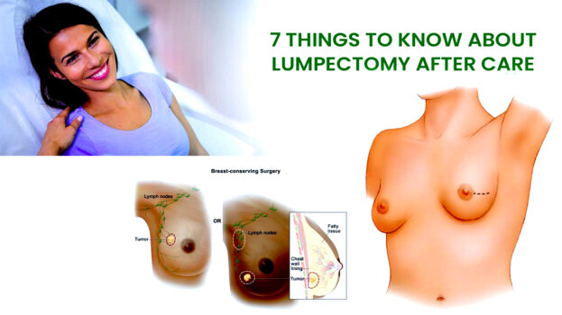 7 Things To Know About Lumpectomy After Care