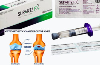 Osteoarthritis Pain Treatment