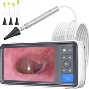 ScopeAround Otoscope Ear Camera with 4.5″ IPS Screen