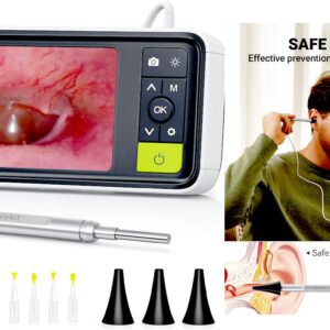 Anykit Digital Otoscope with Gyroscope
