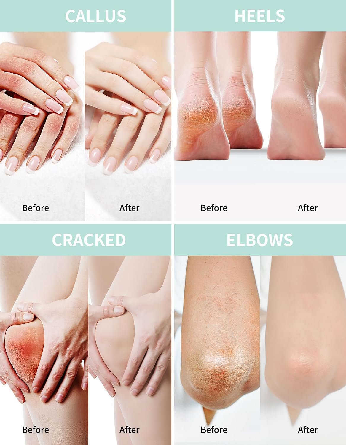 Grocerism Urea Cream 40% for Feet Maximum Strength Hand & Foot Cream 8.82oz - Image 3