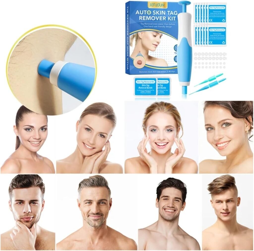 Skin Tag Removal Kit