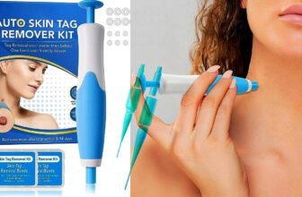 Skin Tag Removal Kit