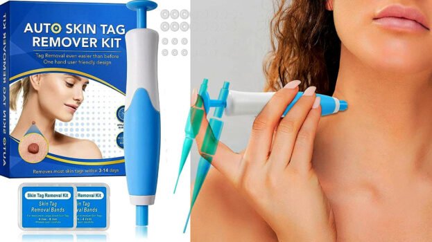 Skin Tag Removal Kit